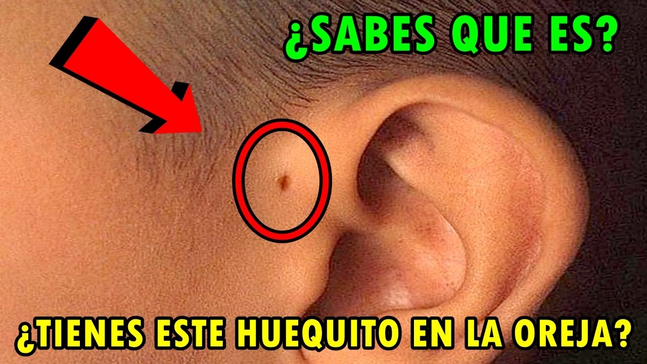 cuanto cuesta hacerse el agujero de la oreja